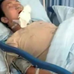 小姐姐出车祸大腿骨折,小姐姐大腿骨折，社会各界爱心涌动